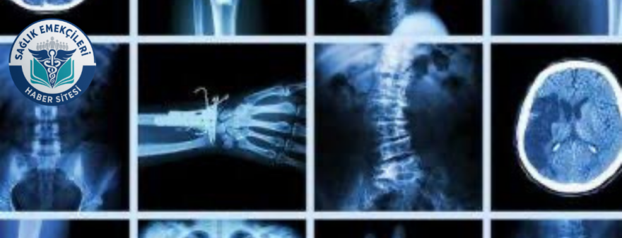Radyoloji Skandalı İddiaları Üzerine Savcılıktan Soruşturma Başlatıldı: Yanlış Raporlar İnceleniyor
